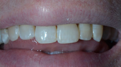 Cosmetic Dentist After Photo